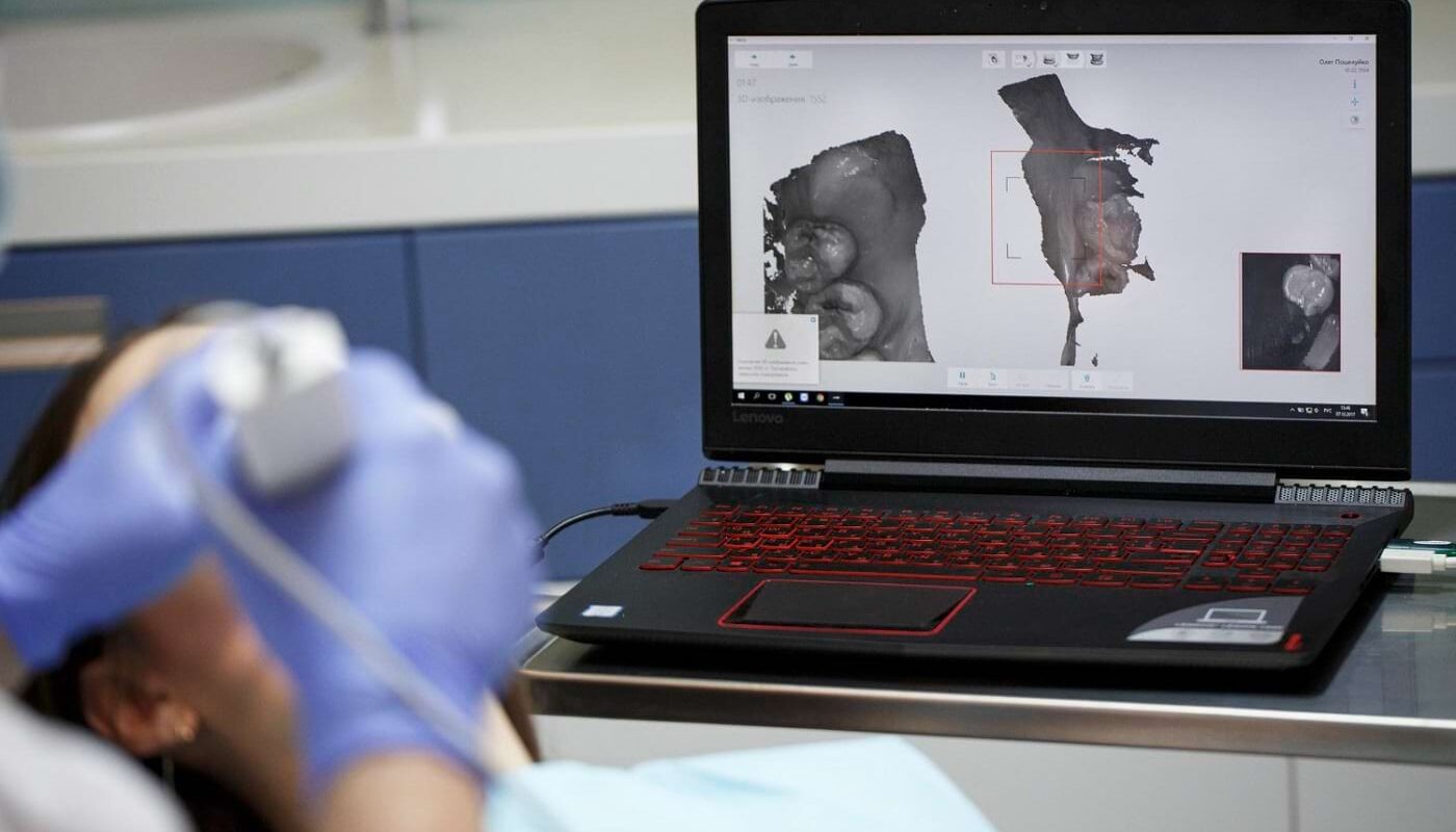 aparat usg przenośny