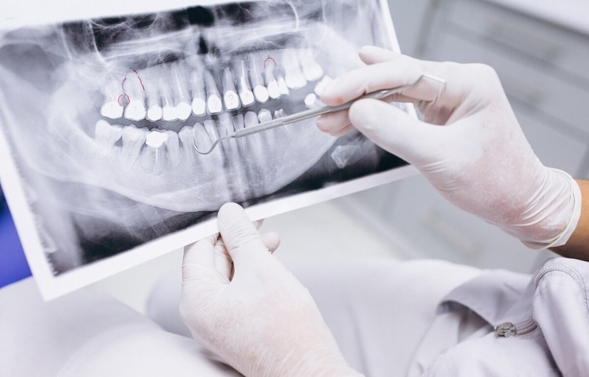 protetyka stomatologiczna